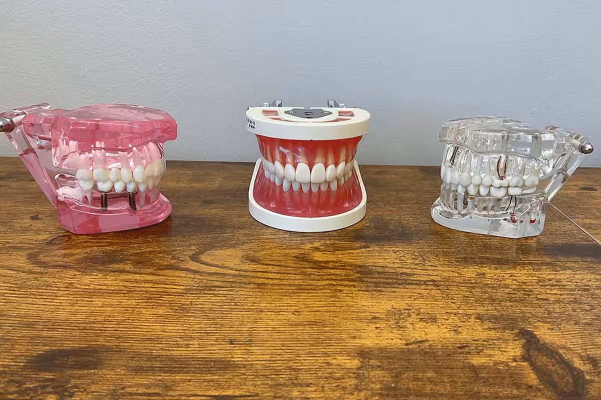 3 Acrylic Models 12x8 Restore
