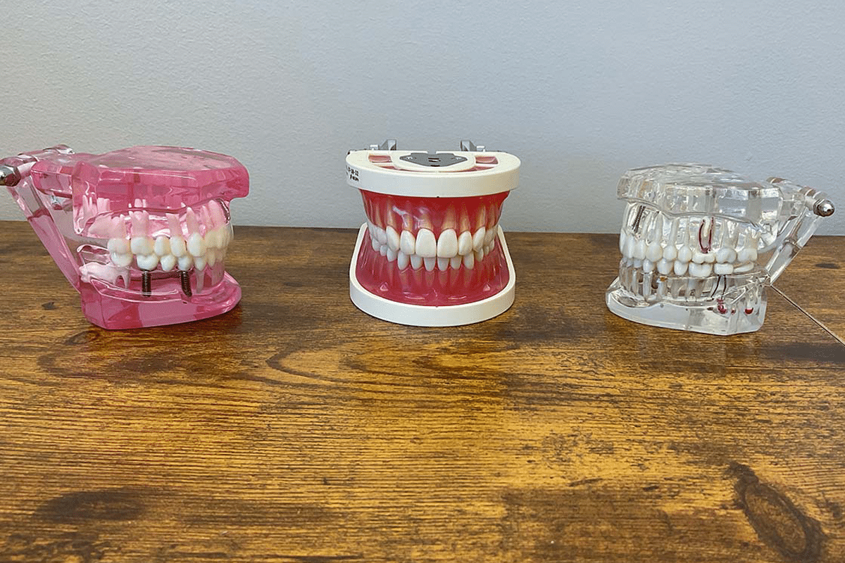 3 Acrylic Models 12x8 Restore