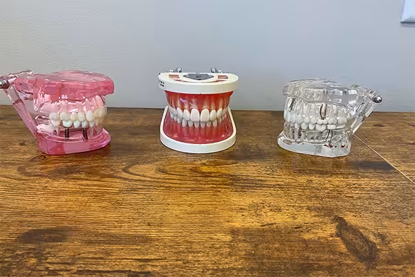 3 Acrylic Models 6x4