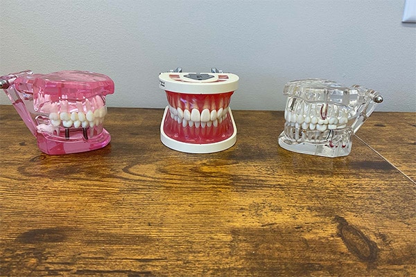 3 Acrylic Models 6x4