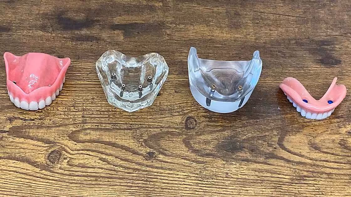 Acrylic Mods 1120x630