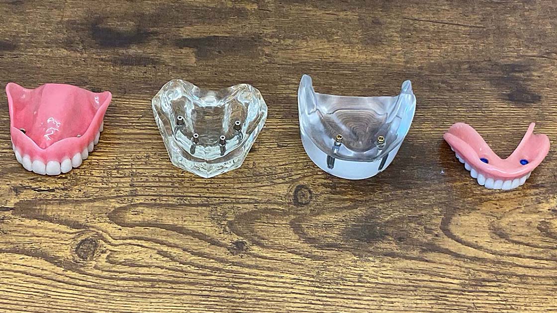 Acrylic Mods 1120x630
