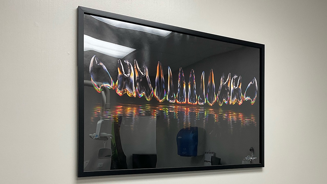 Artwork Full Teeth